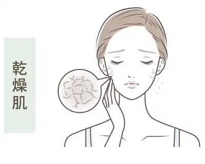 ❷ 乾性肌